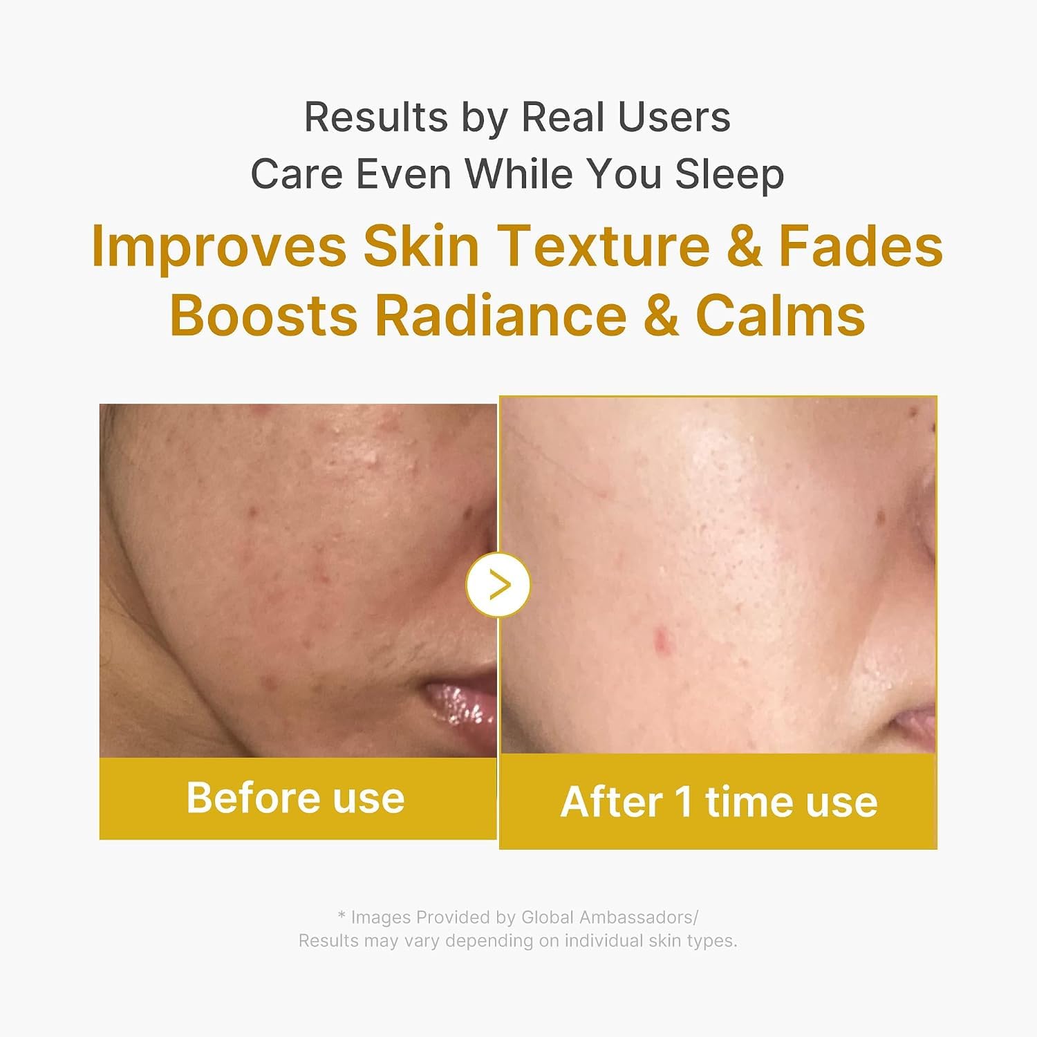 Medicube Kojic Acid masque nuit peel-off curcuma Turmeric 2.0