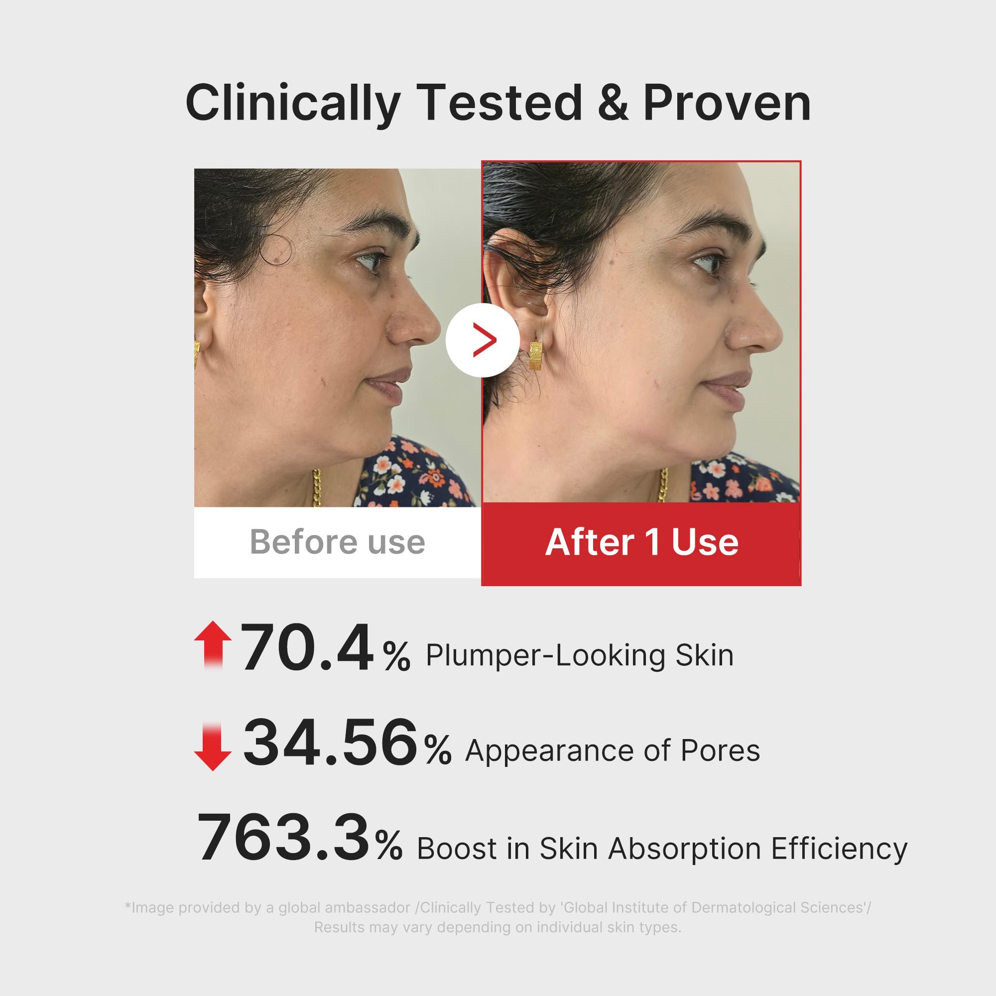 Medicube AGE-R Booster Pro appareil visage rose 6-en-1 glow
