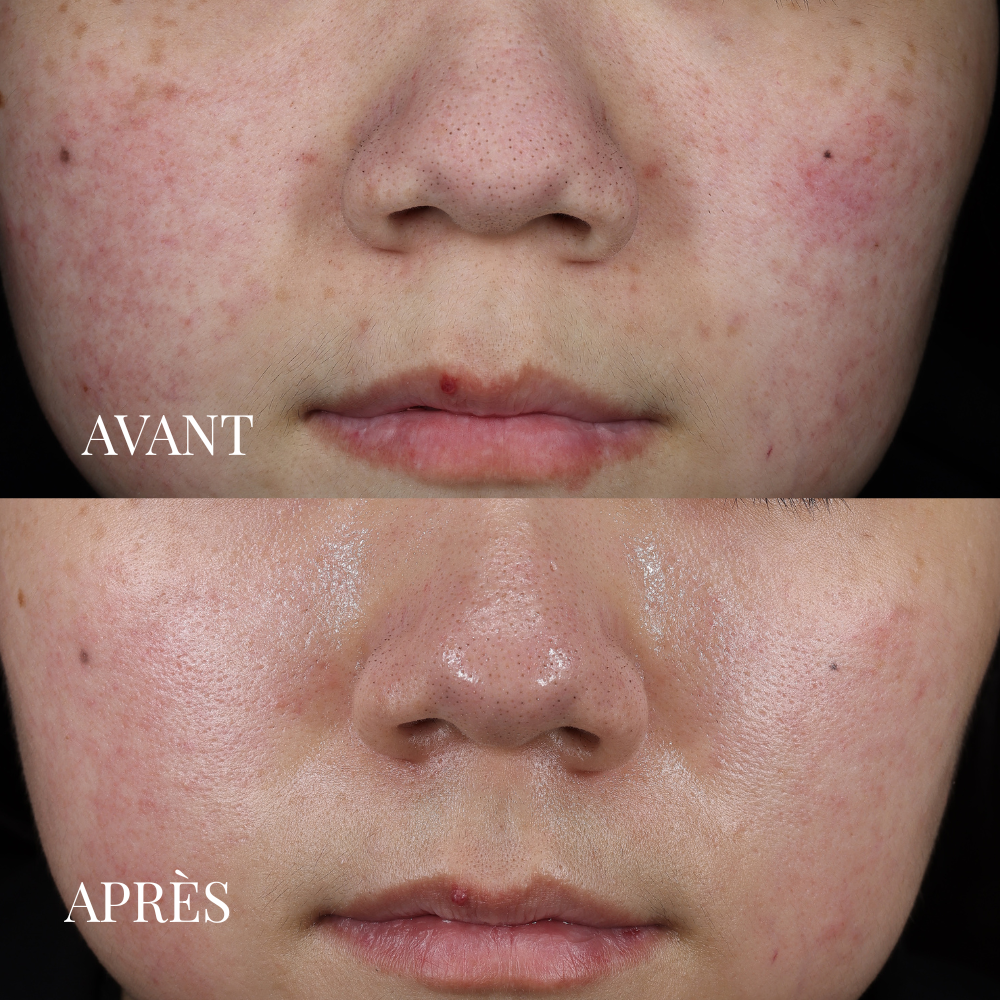 JOD Les Soins Experts Masque Visage Détoxifiant Argile Verte 20g