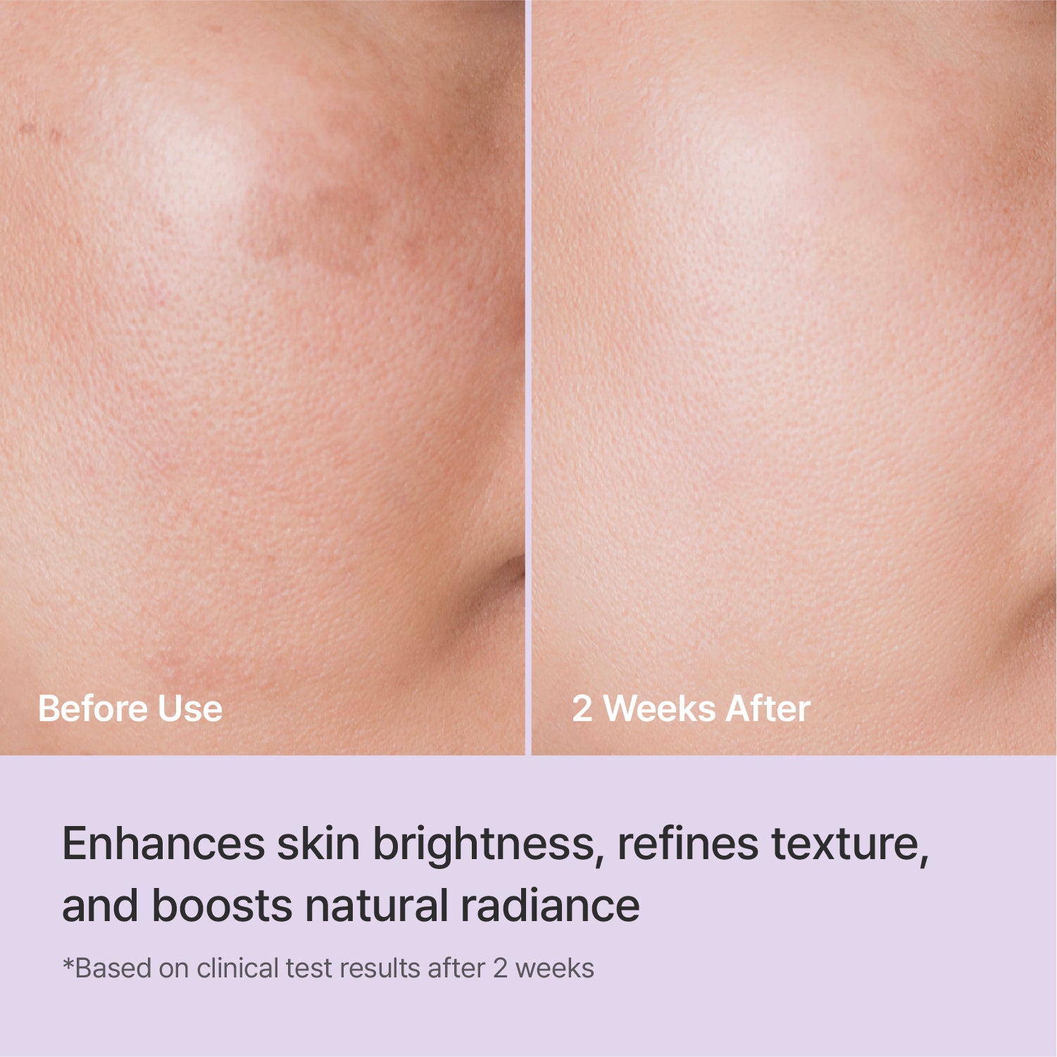 Rejuran Triple Radiance Ampoule sérum éclat 30 ml