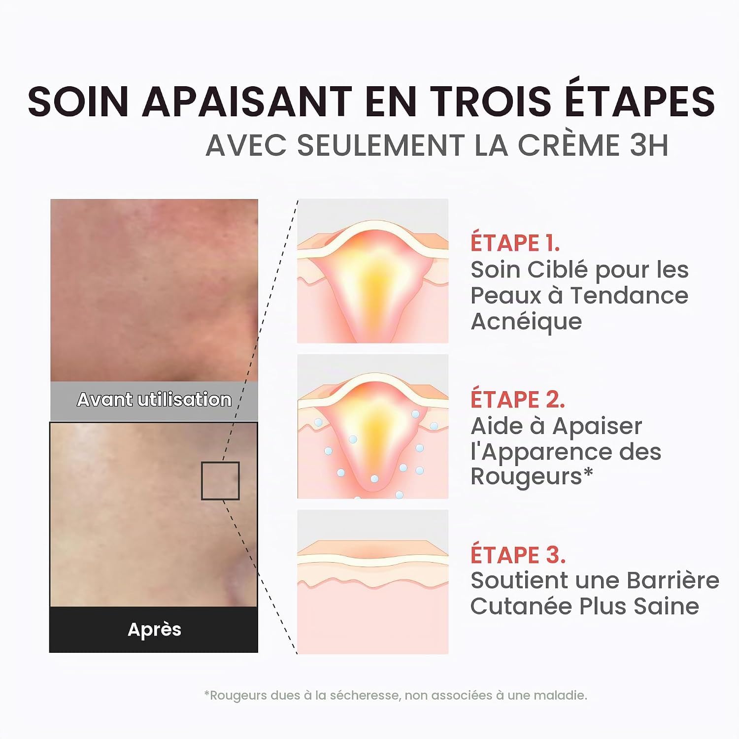 Medicube Super Cica 3H Daily Relief crème visage apaisante céramide