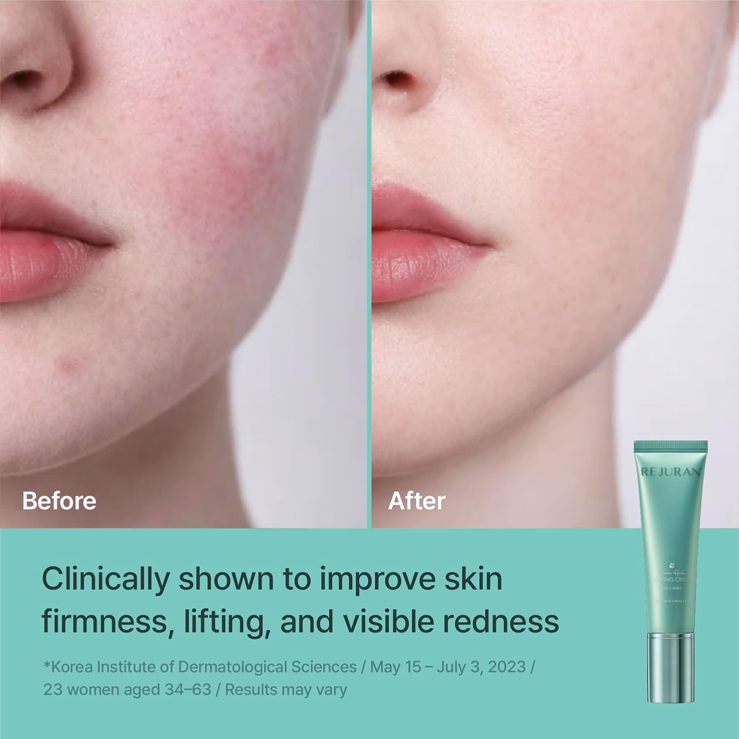 Rejuran Recover Firming Cream crème visage 50 ml fermeté