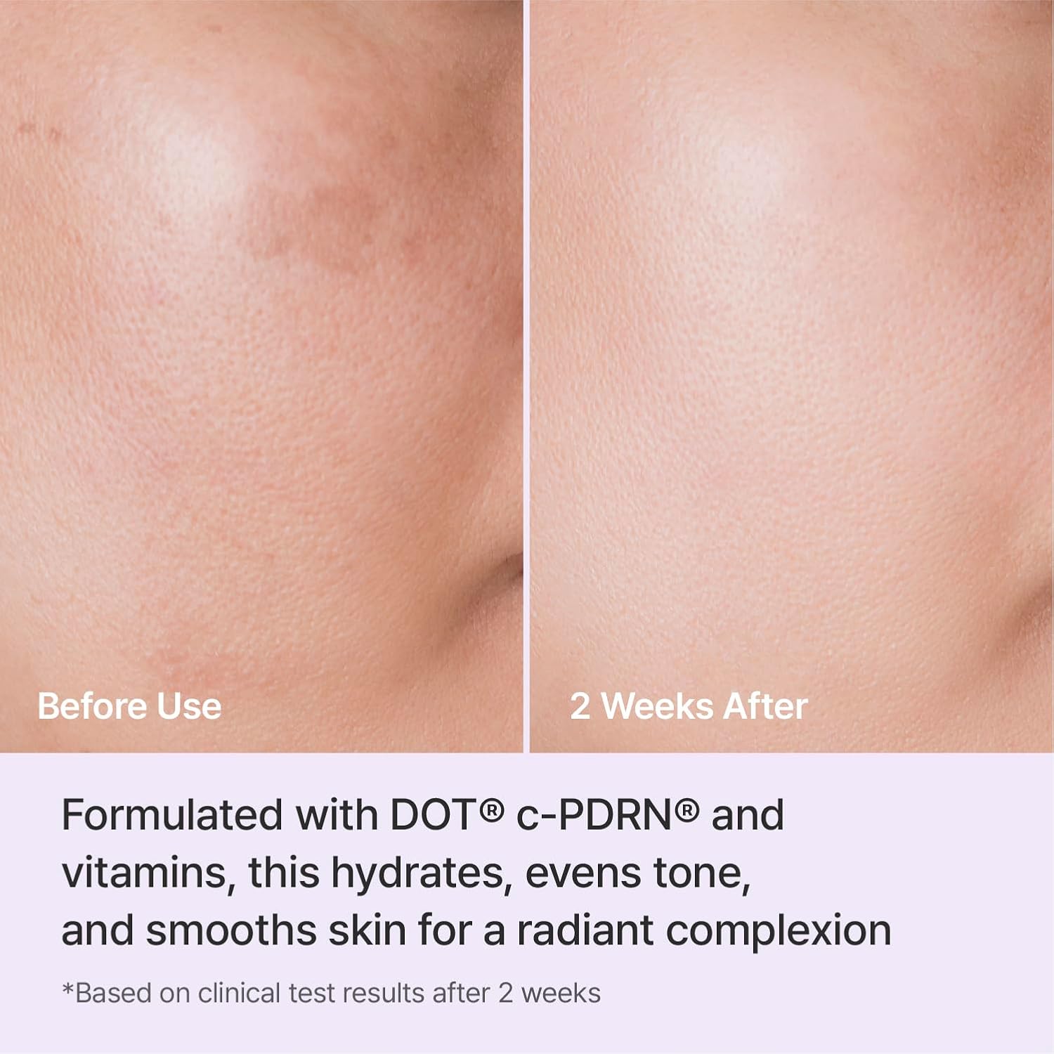 Rejuran Triple Radiance Cream crème éclat hydratante c-PDRN