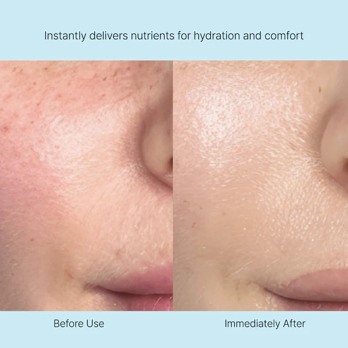 Rejuran Moisturizers Nutritive Cream crème visage 1 pot nourrissante