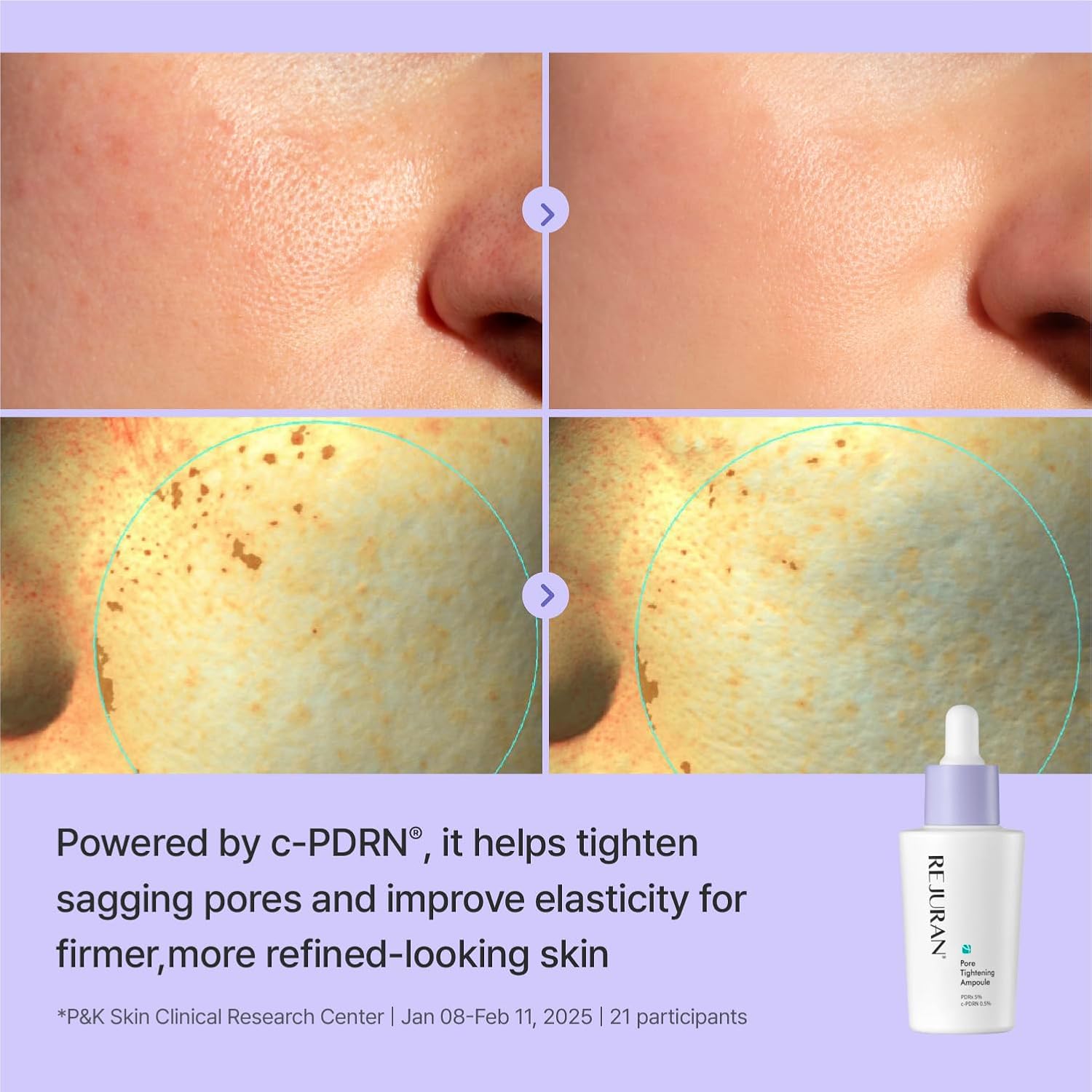 Rejuran Pore Tightening Ampoule sérum pores dilatés 30mL