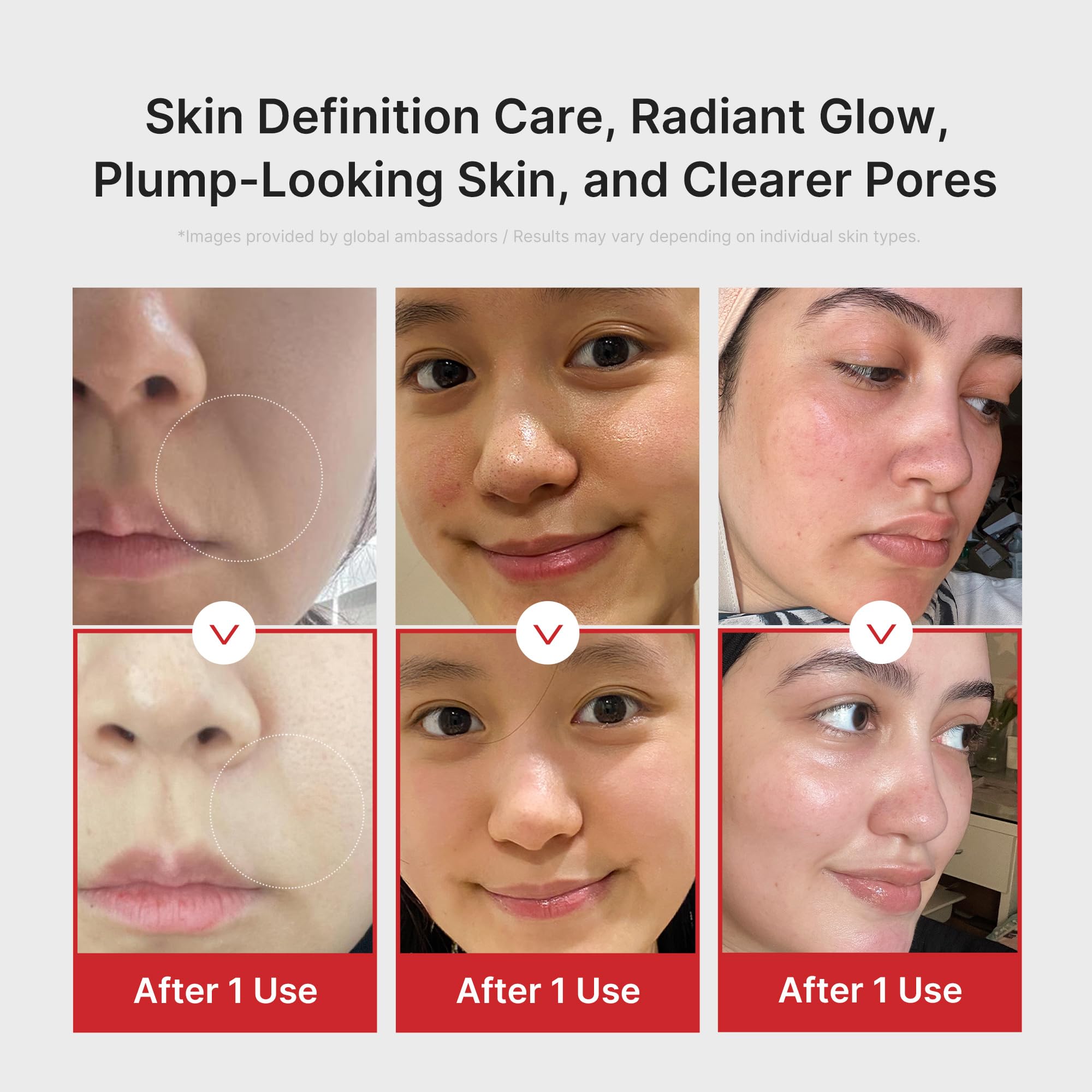 Medicube AGE-R Booster Pro appareil visage rose 6-en-1 glow