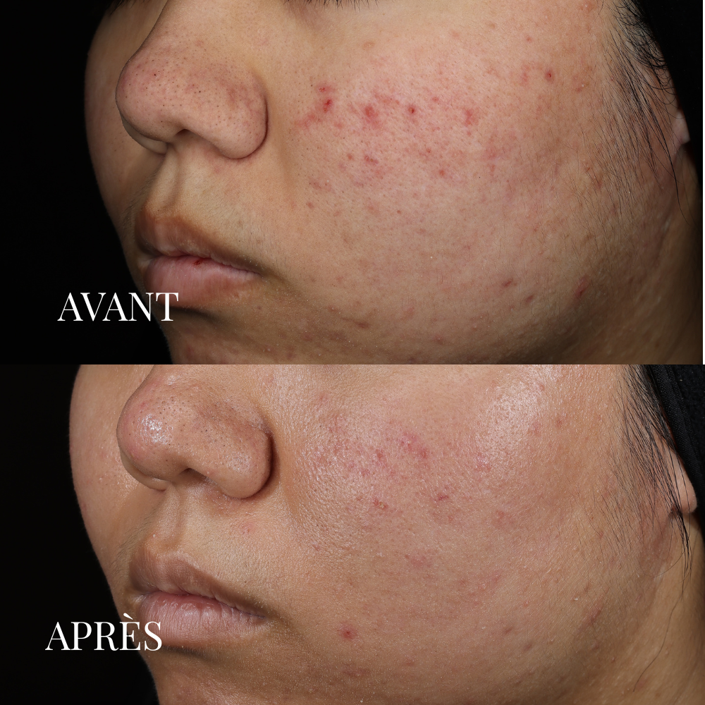JOD Les Soins Experts Masque Visage Détoxifiant Argile Verte 20g