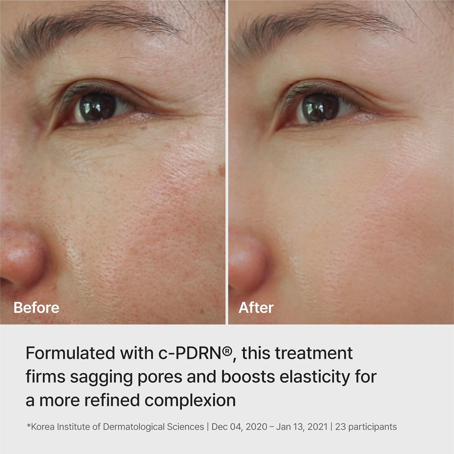 Rejuran Ampoule Infused Lifting Mask masque 28g x 4 liftant