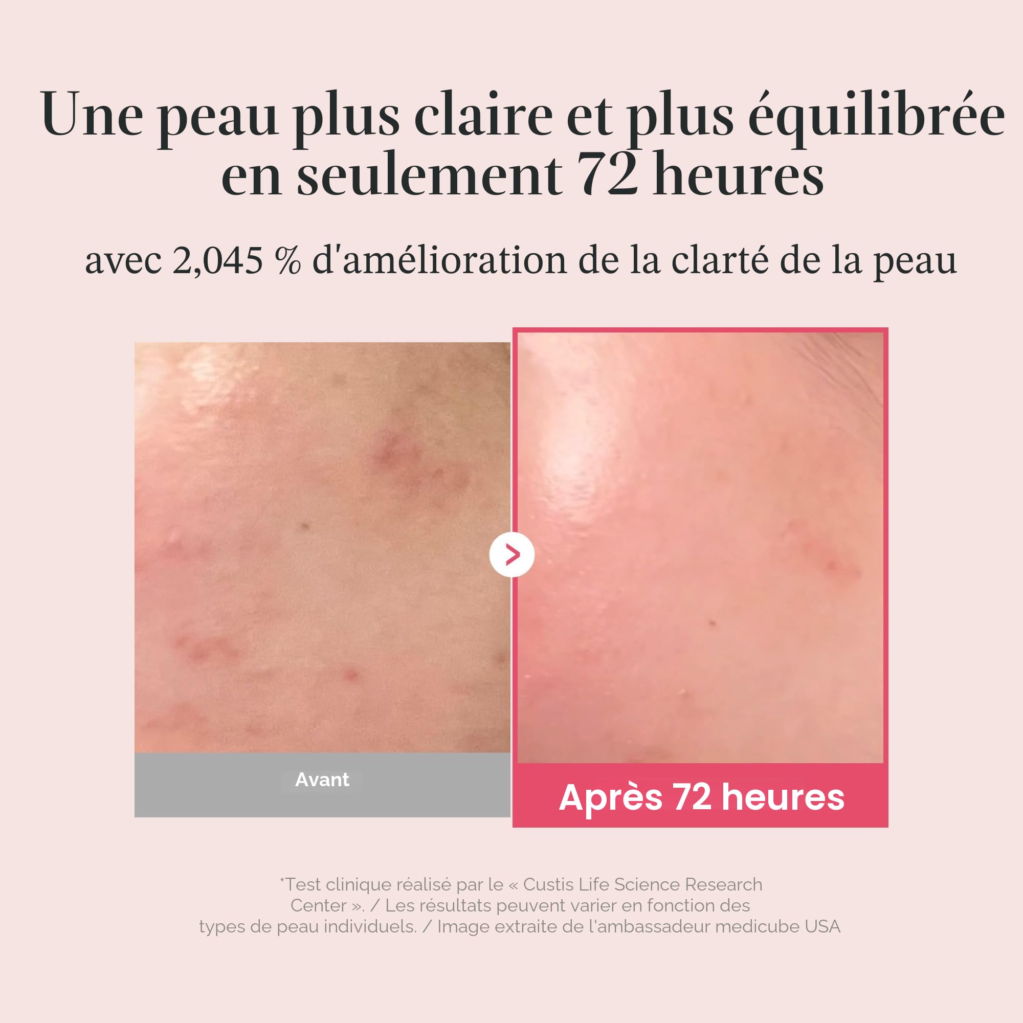 Medicube TXA sérum visage niacinamide taches brunes