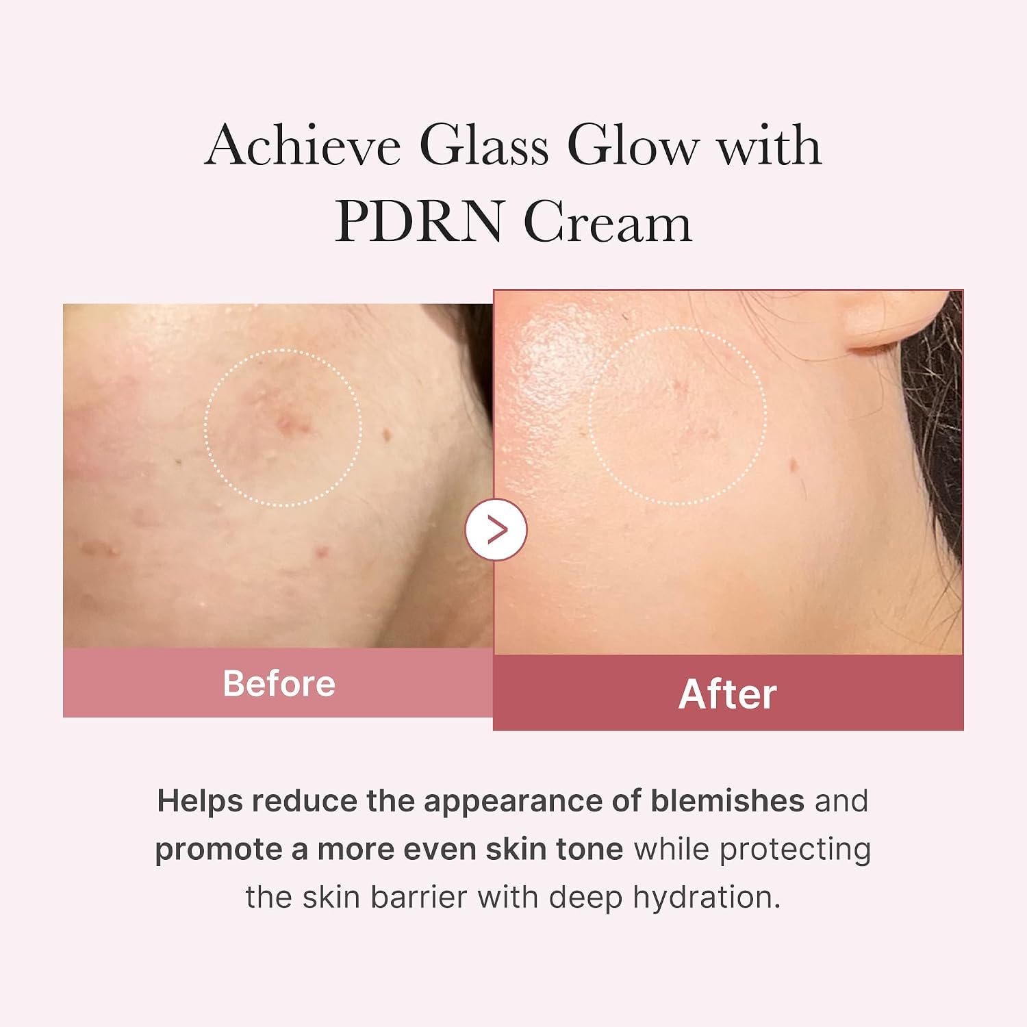 Medicube PDRN Pink crème hydratante ADN saumon hyaluron