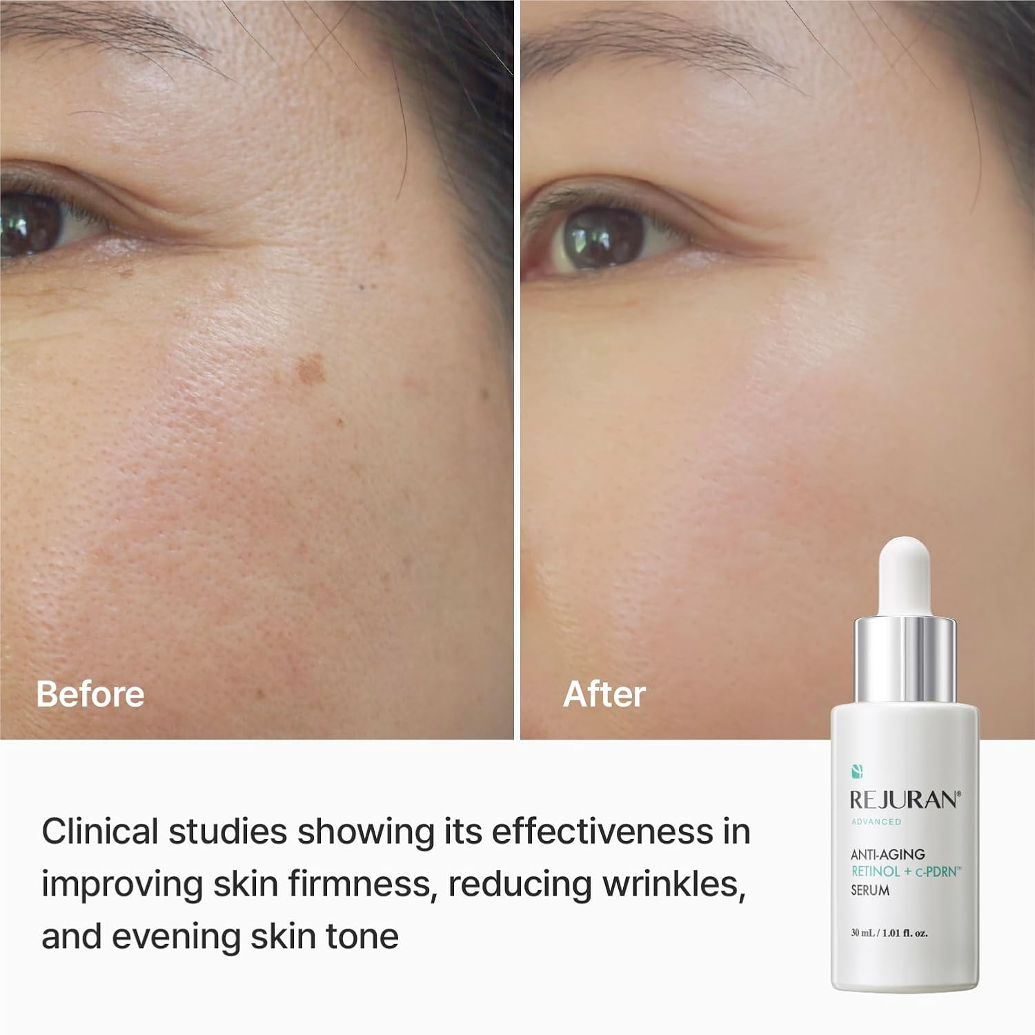 Rejuran Advanced Retinol c-PDRN Serum sérum anti-âge