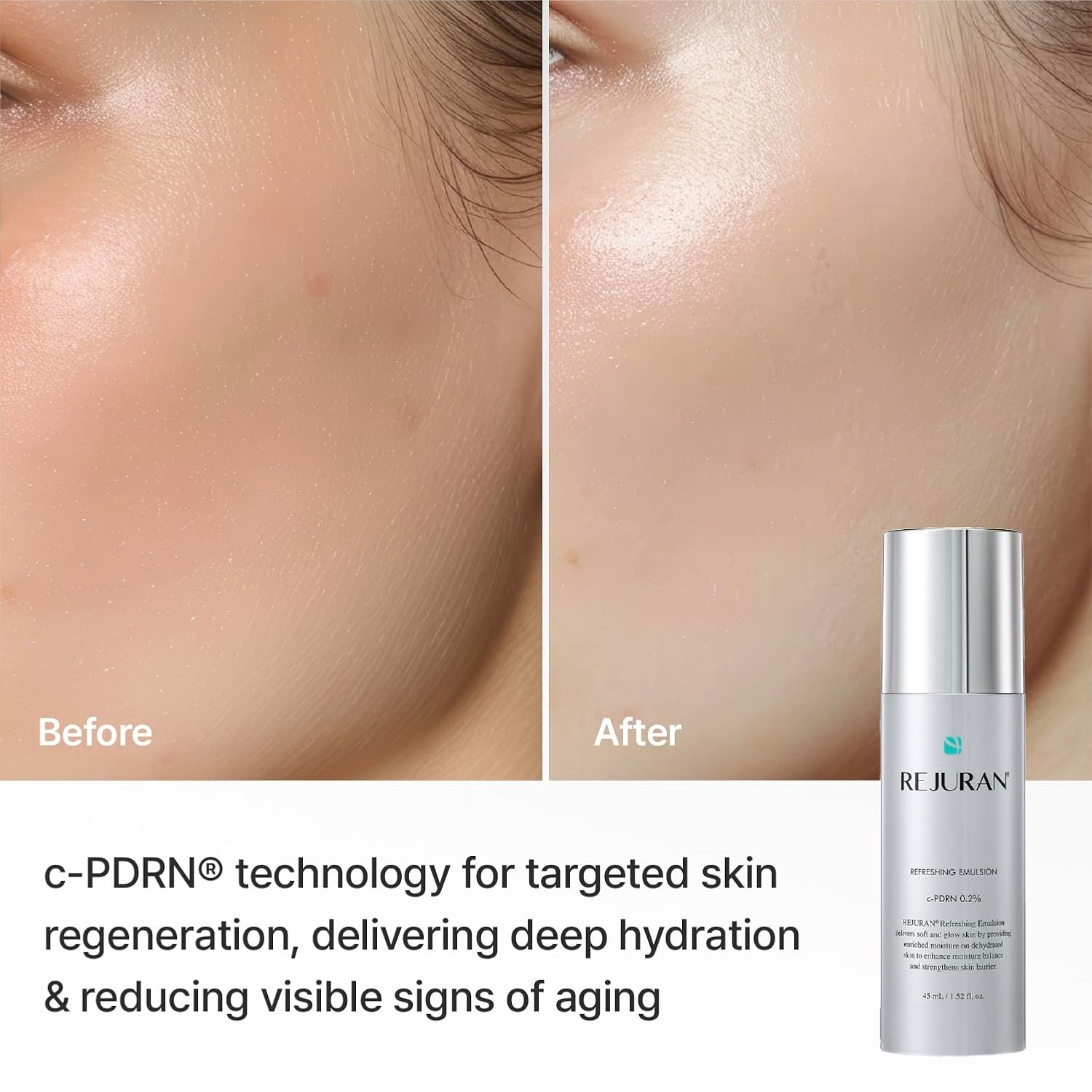 Rejuran Refreshing Emulsion émulsion visage hydratante légère