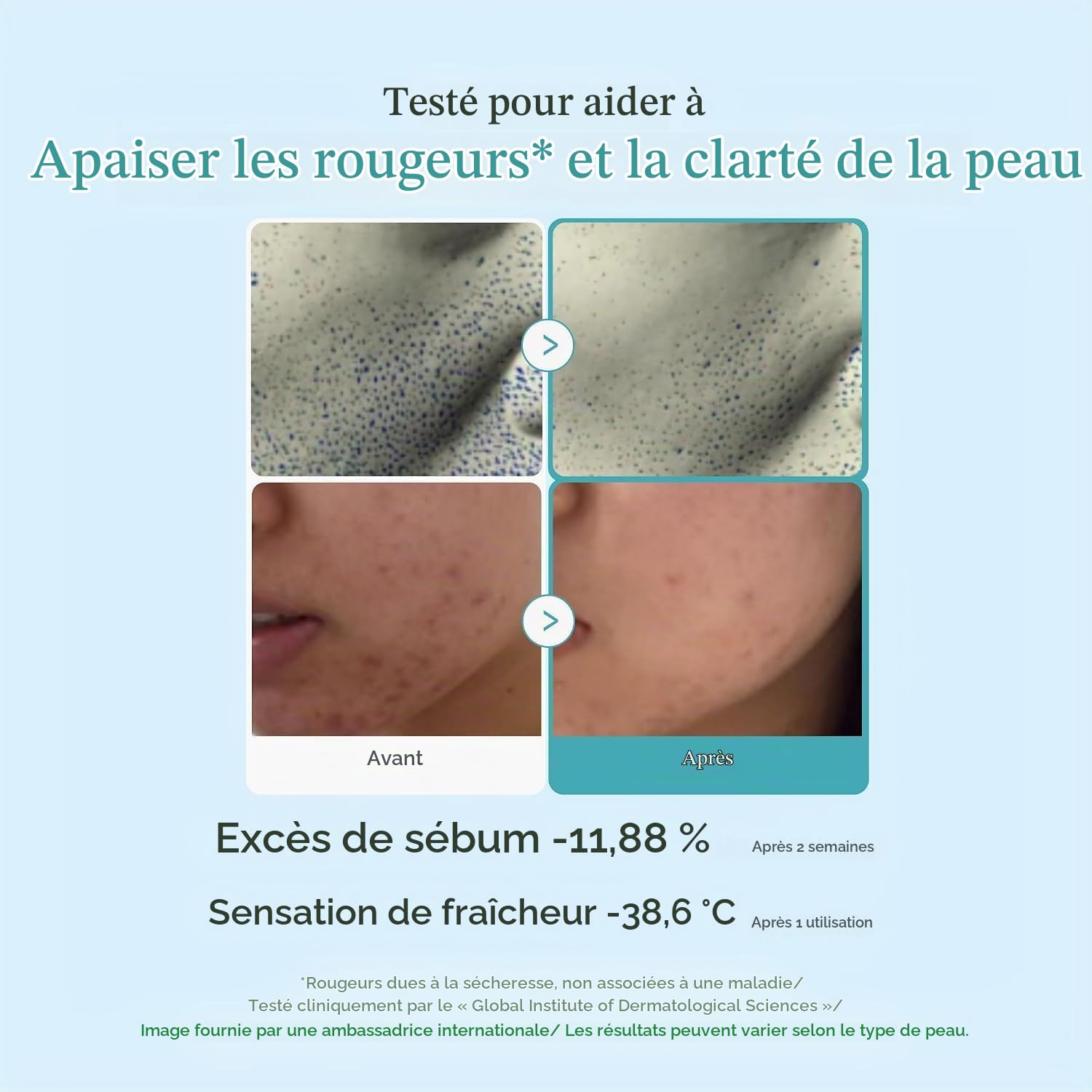Medicube Red Lotion Tonique acide azélaïque niacinamide 250 ml