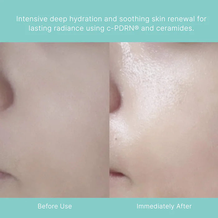 Rejuran Masks & Treatments Turnover Mask masque nuit 1 boîte apaisant
