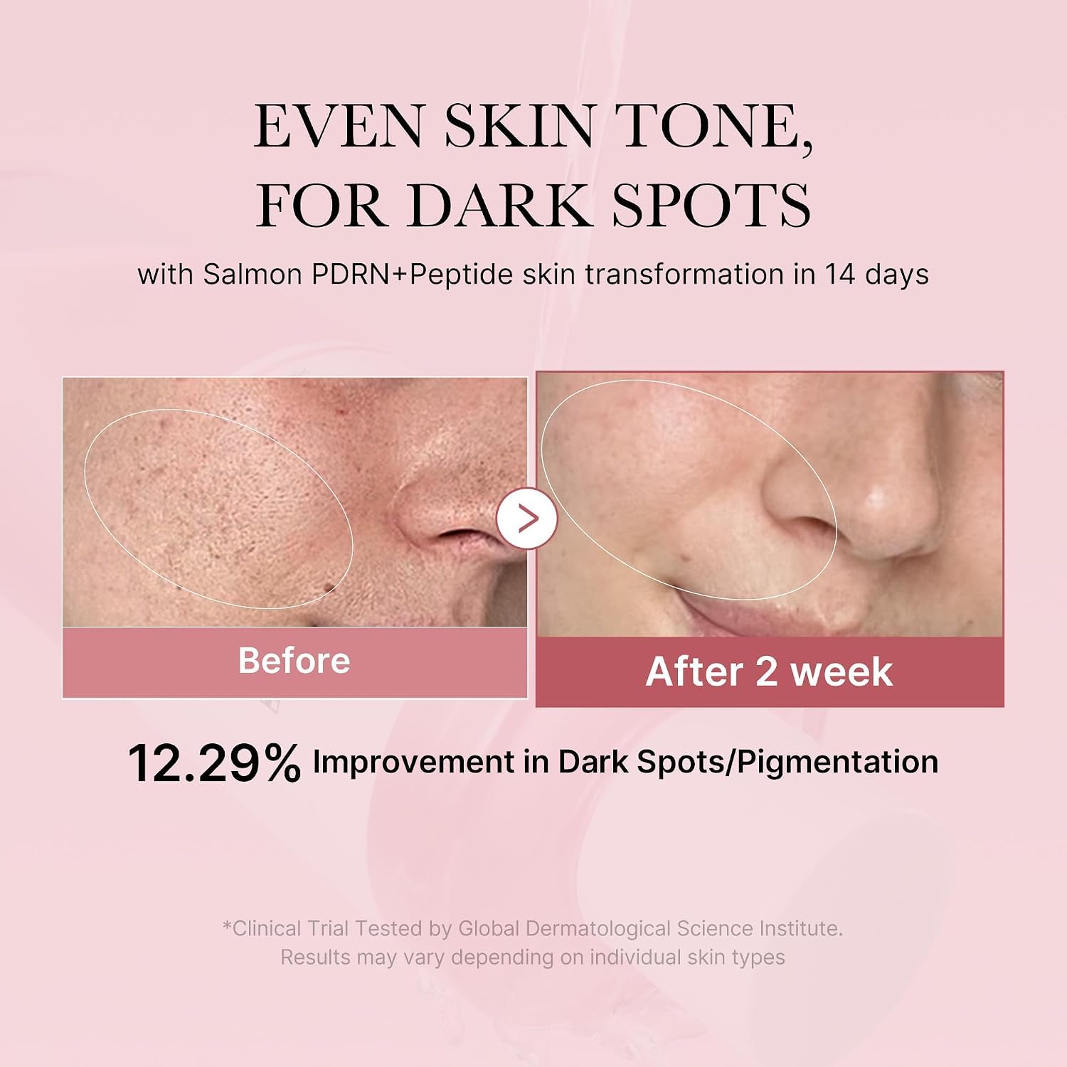 Medicube PDRN Pink lotion tonique Watery ADN saumon sensible