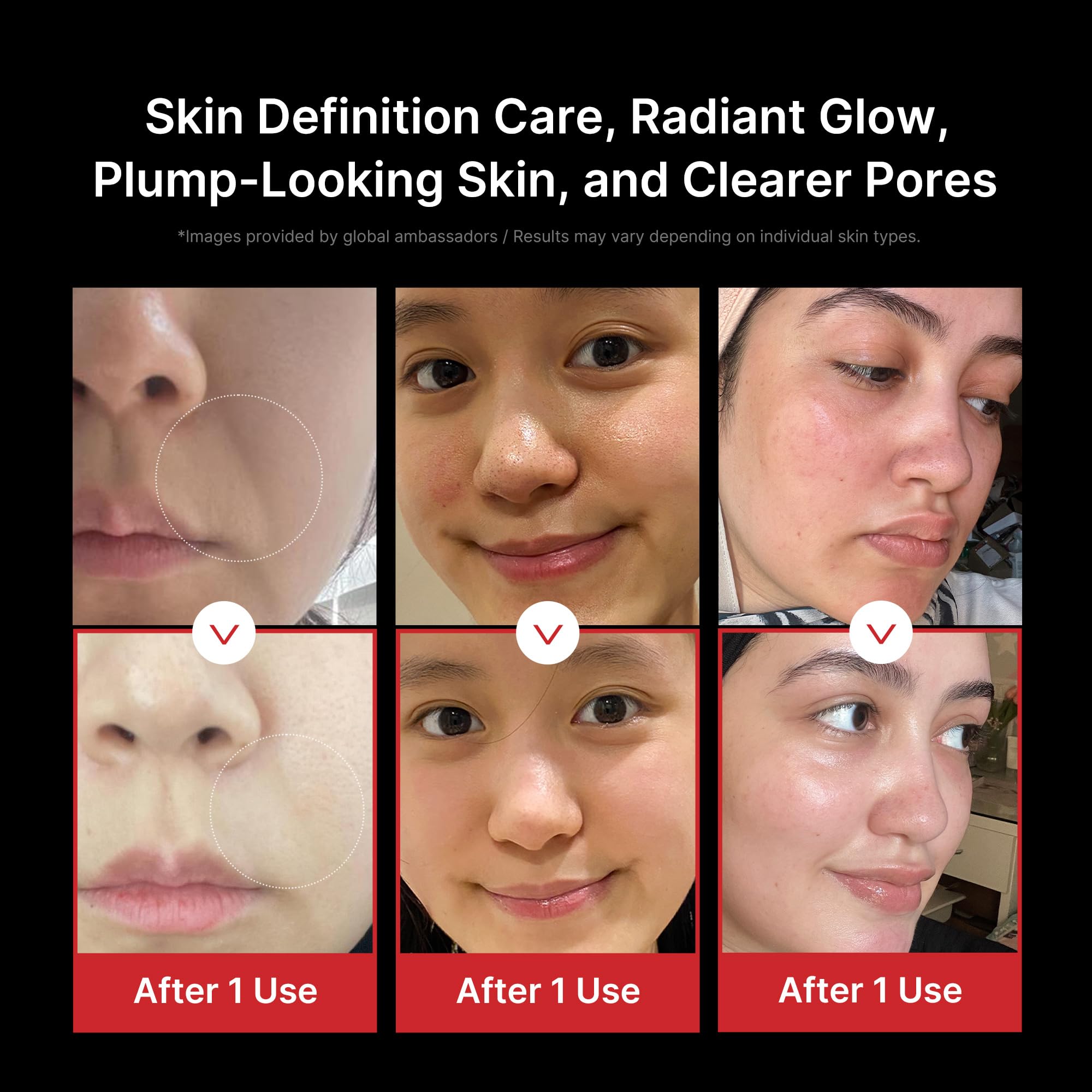 Medicube AGE-R Booster Pro appareil visage 6-en-1 Noir