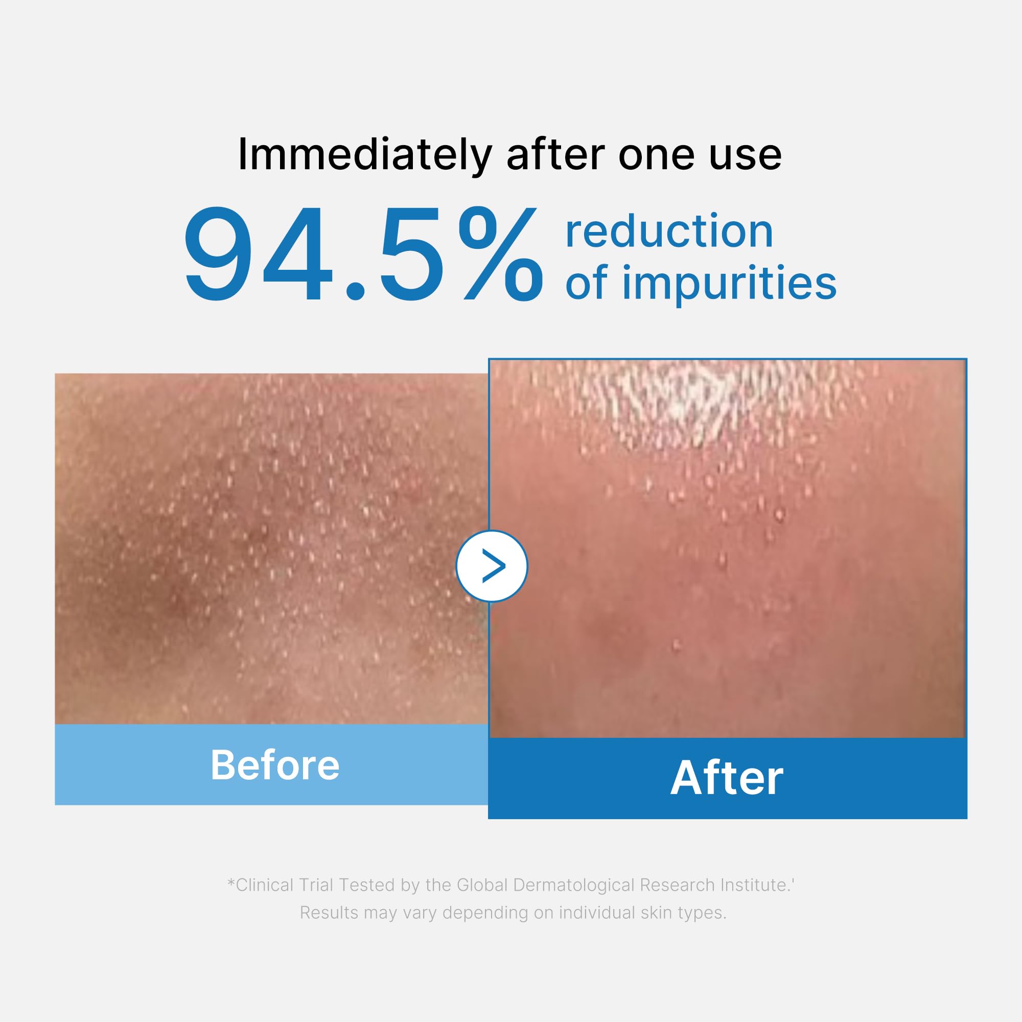 Medicube Zero Pore huile nettoyante points noirs sébum
