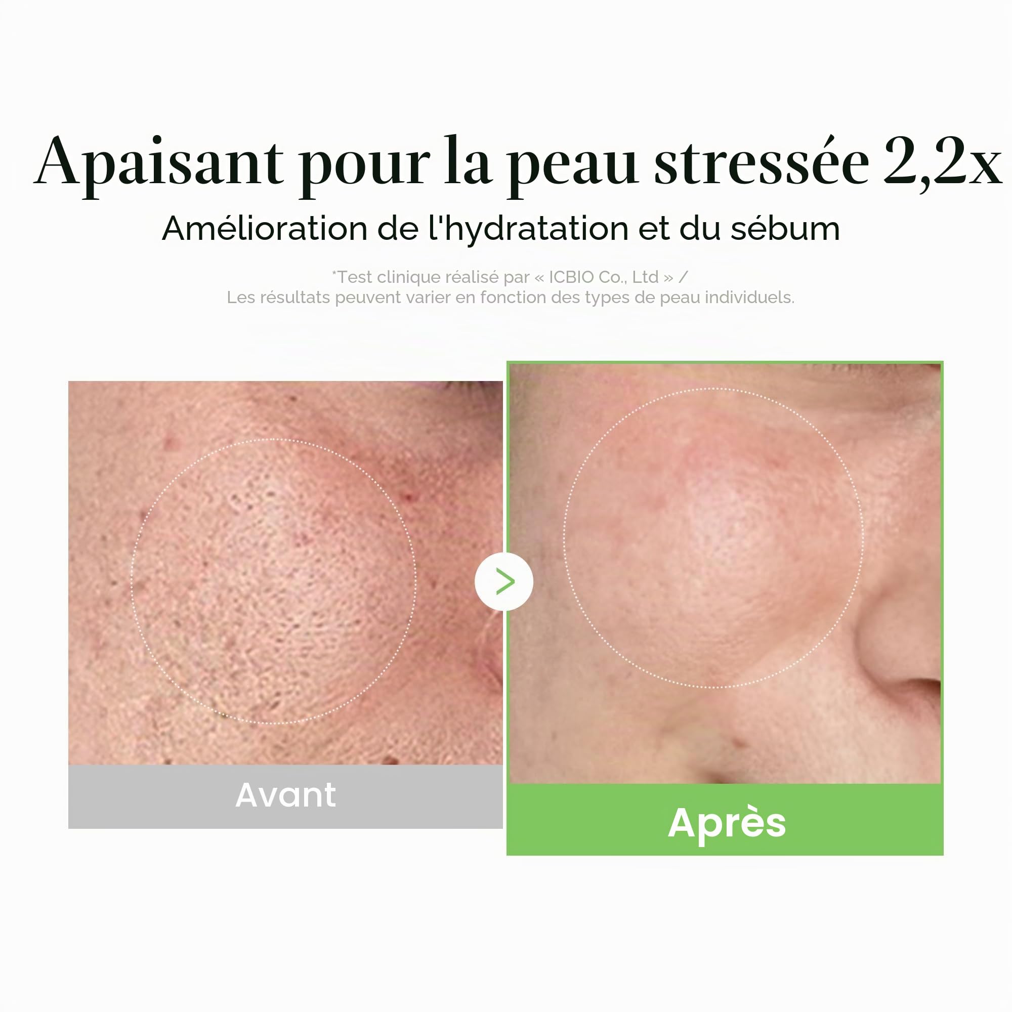 Medicube Super Cica Crème Exosome CICA crème visage 50 ml