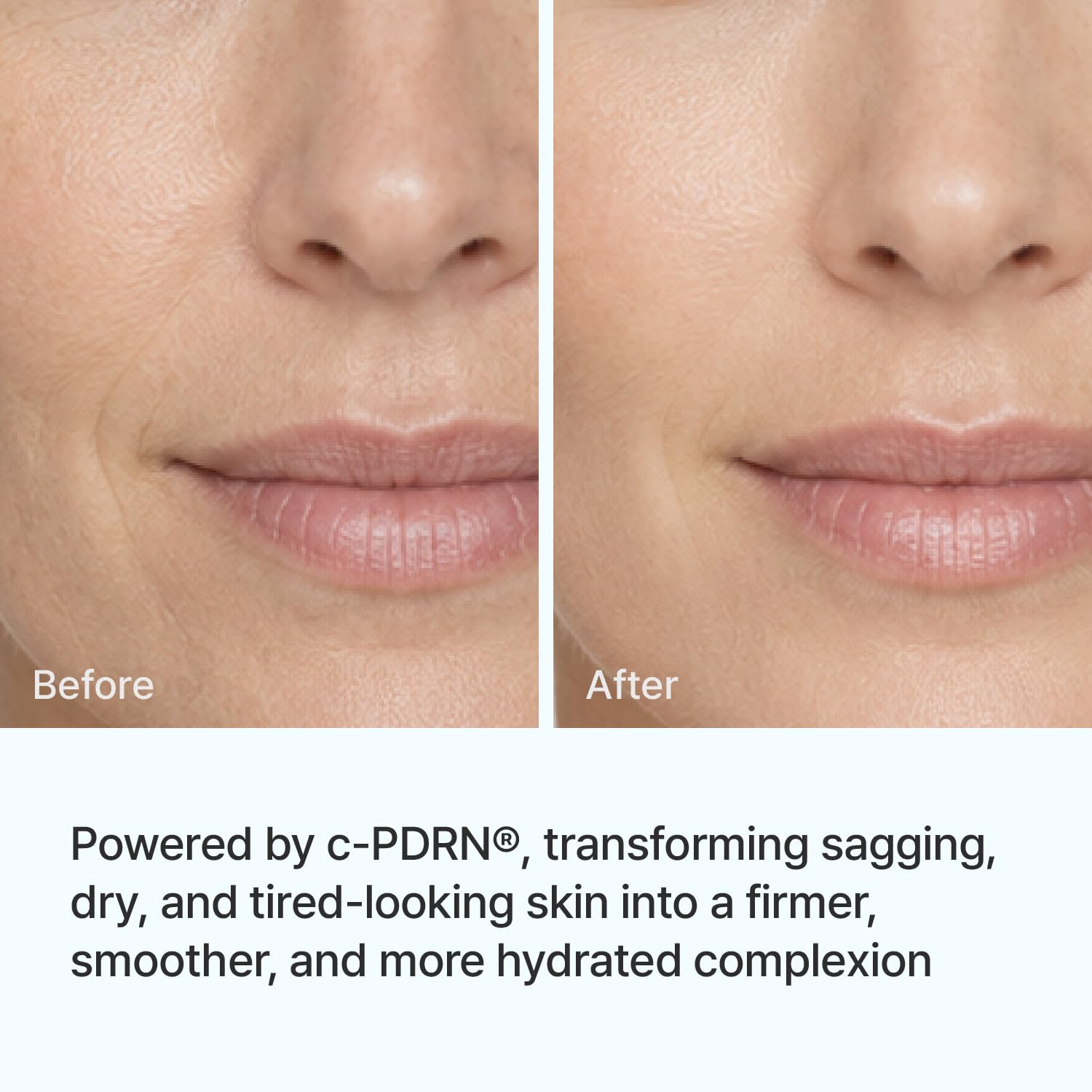 Rejuran Moisturizers Advanced Face & Neck Firming Cream crème pot lift