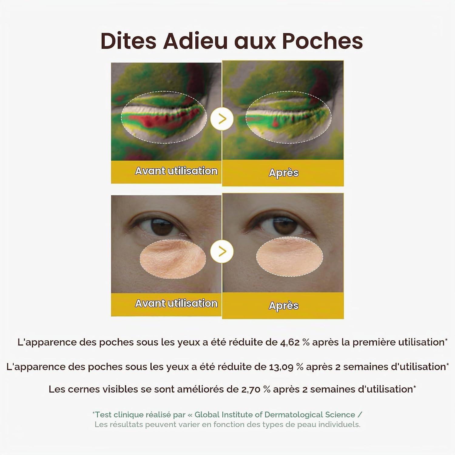 Medicube Kojic Acid gel yeux curcuma 30 ml éclat